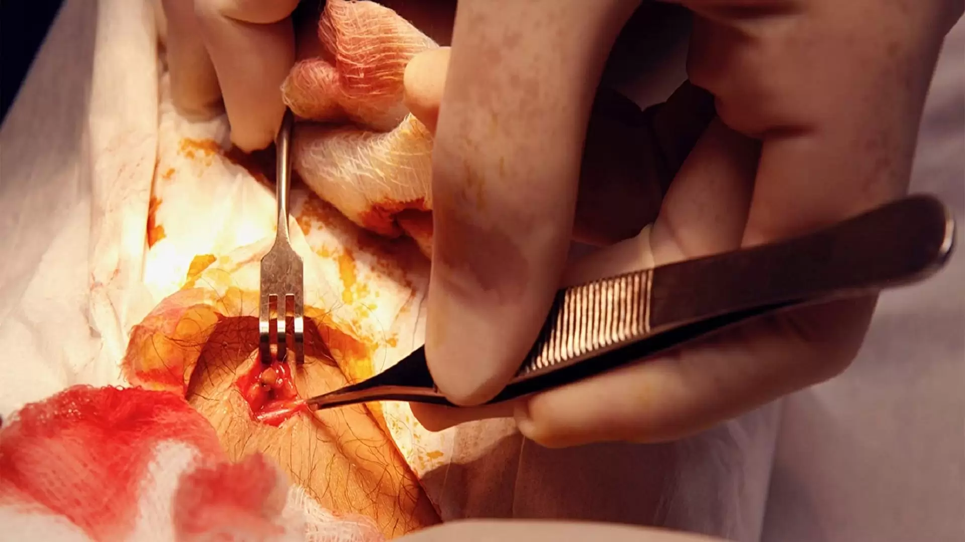 دانلود مستند Patient Seventeen 2015
