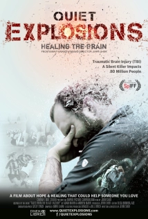 دانلود مستند Quiet Explosions: Healing the Brain 2019 (هیاهوی خاموش)