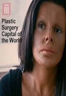 دانلود فیلم Plastic Surgery Capital of the World 2018 (پایتخت جراحی پلاستیکlink= جهان)